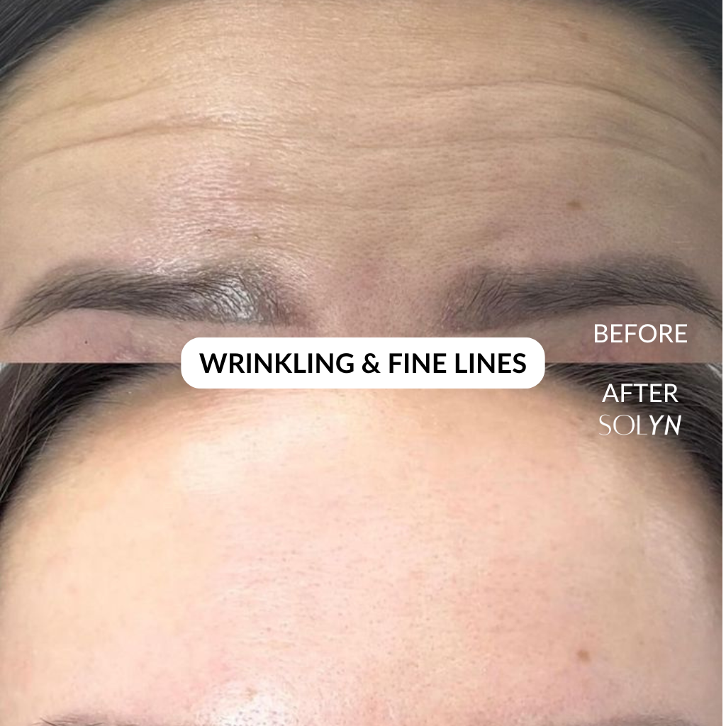 Solyn® PDRN Pink Collagen Cream - BOGO Sale